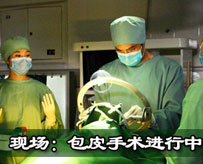 手术
