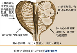 加拿大生物反馈治疗技术简介 加拿大生物反馈治疗技术简介