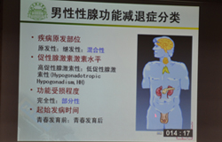 男性性腺功能减退症分类 男性性腺功能减退症分类